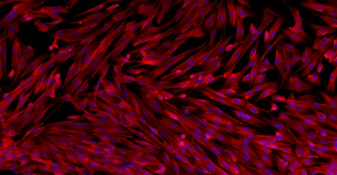 Primary Rat Bladder Stromal Fibroblasts (BSF)