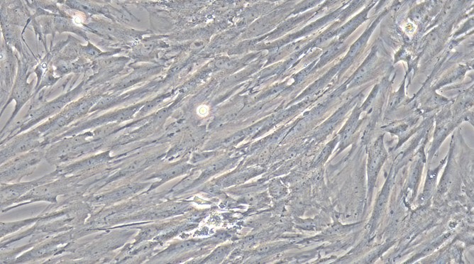 Primary Rat Bladder Stromal Fibroblasts (BSF)