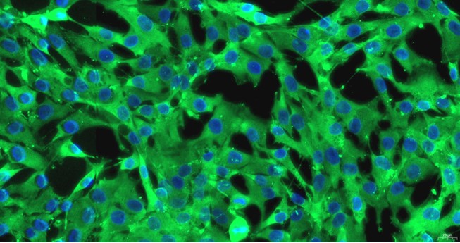 Primary Feline Tracheal Smooth Muscle Cells (TSMC)