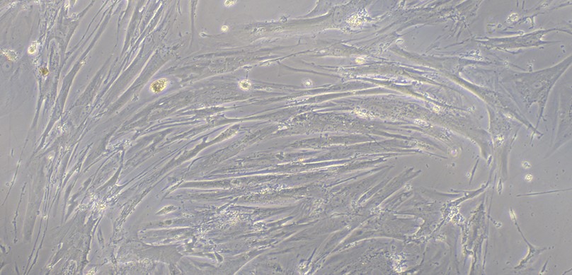 Primary Human Hepatic Stellate Cells (HSC)