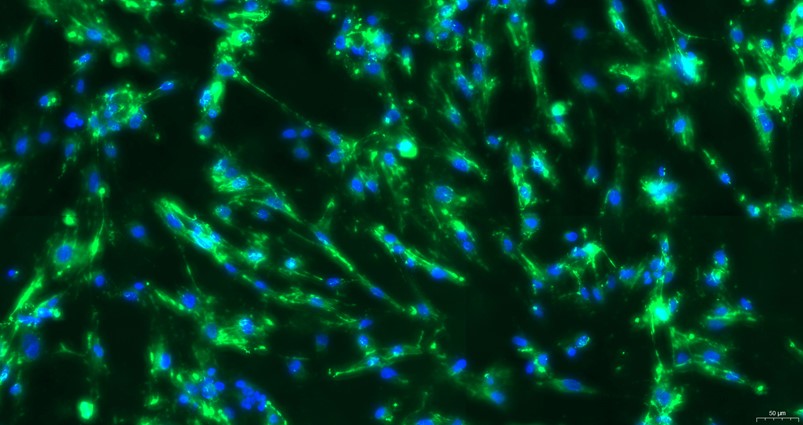 Primary Mouse Intestinal Fibroblasts (IF)