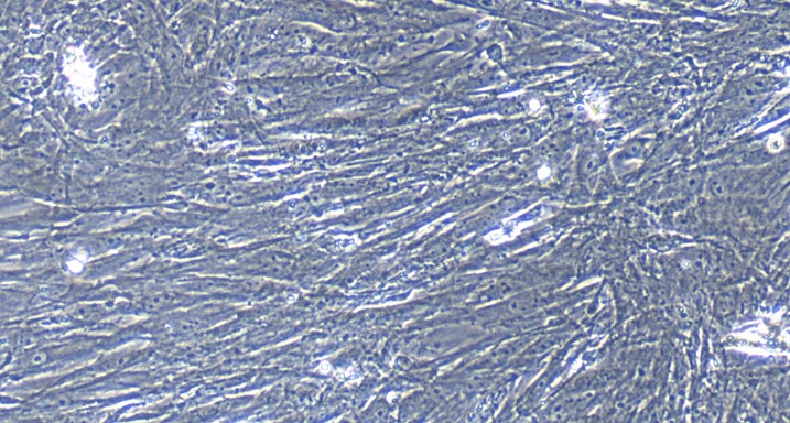 Primary Mouse Intestinal Fibroblasts (IF)