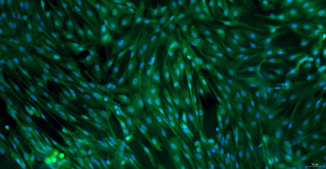 Primary Feline Adult Epidermal Keratinocytes (AEK)