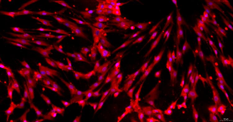 Primary Human Periodontal Ligament Fibroblasts (PDLF)