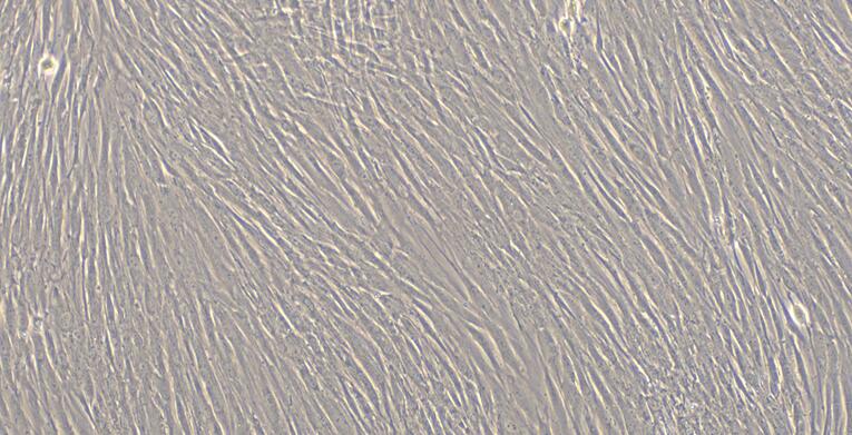 Primary Human Periodontal Ligament Fibroblasts (PDLF)