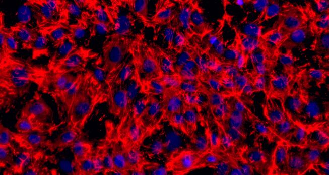 Primary Rat Cardiac Fibroblasts (CF)