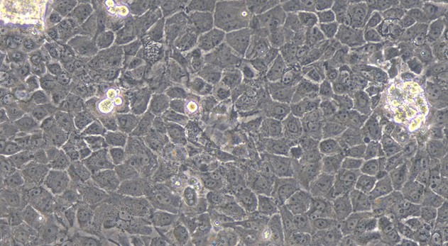 Primary Rat Mammary Epithelial Cells (MEC)