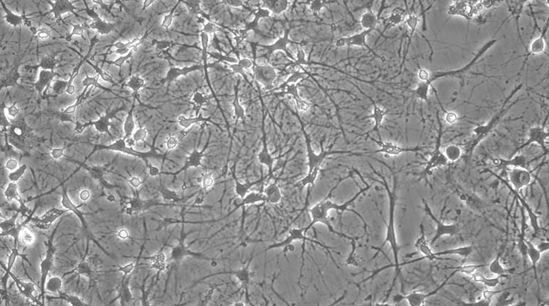 Primary Rat Hippocampal Neuron Cells  (HNC)