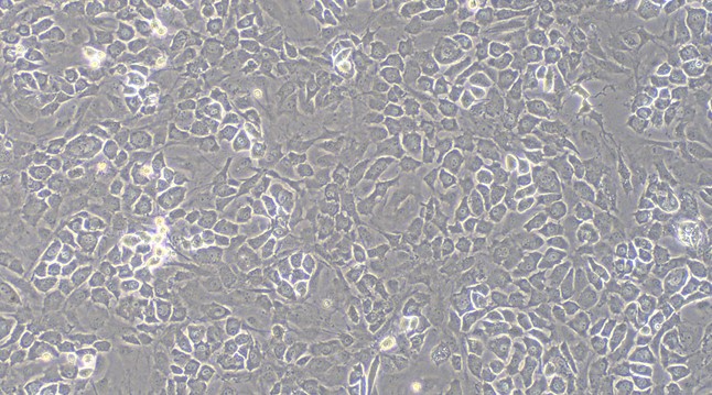 Primary Mouse Osteoblasts (OB)