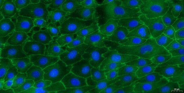 Primary Mouse Colonic Epithelial Cells (CEC)