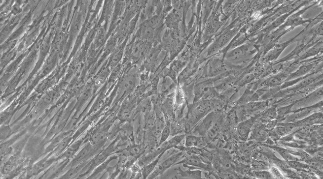 Primary Mouse Colonic Smooth Muscle Cells (CSMC)