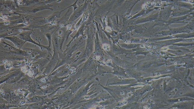 Primary Mouse Esophageal Smooth Muscle Cells (ESMC)