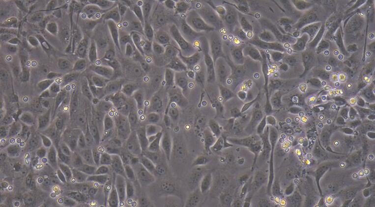 Primary Mouse Cervical Epithelial Cells (CrEC)