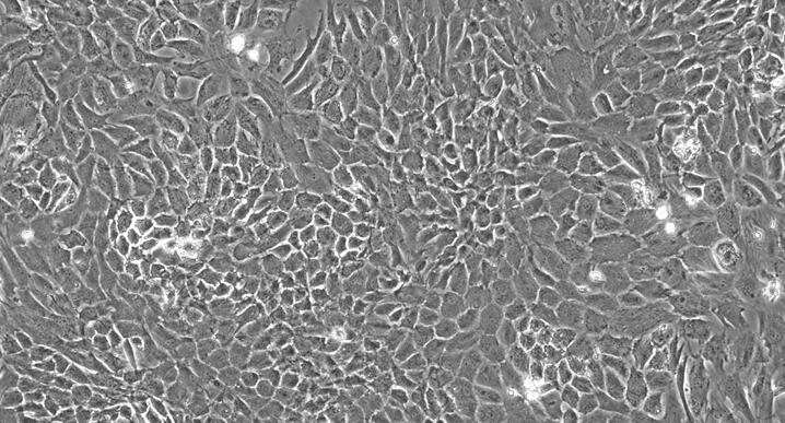 Primary Rabbit Nucleus Pulposus Cells (NPC)