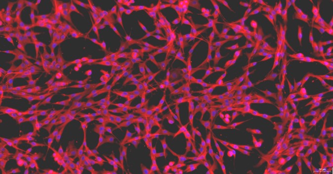 Primary Feline Synovial Cells (SYC)