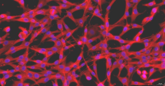 Primary Feline Synovial Cells (SYC)