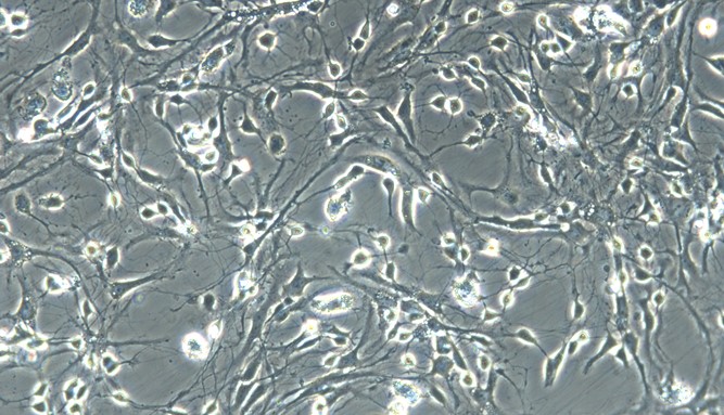 Primary Rat Cerebellar Granule Cells (CGC)