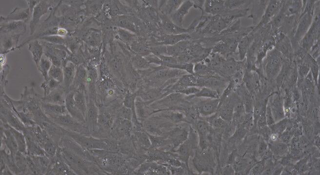 Primary Rabbit Coronary Artery Endothelial Cells (CAEC)