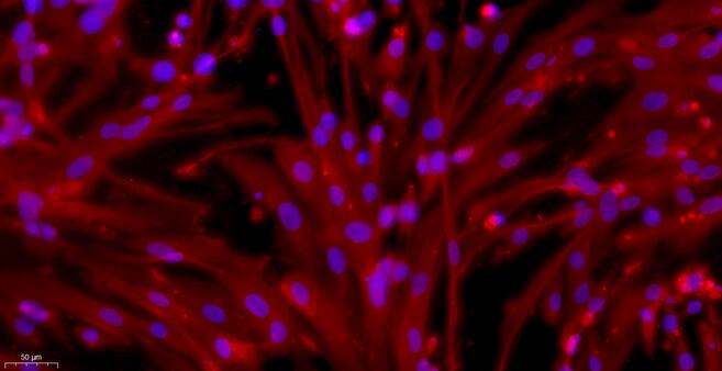 Primary Rabbit Coronary Artery Endothelial Cells (CAEC)