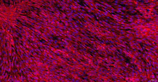 Primary Feline Pericardial Fibroblasts (PF)