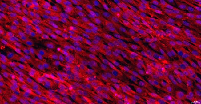 Primary Feline Pericardial Fibroblasts (PF)