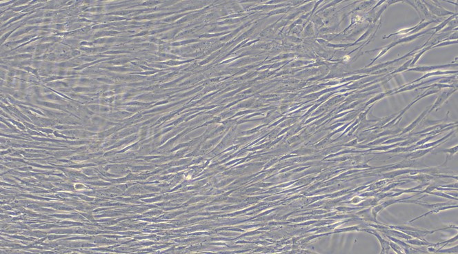 Primary Feline Aortic Smooth Muscle Cells (ASMC)