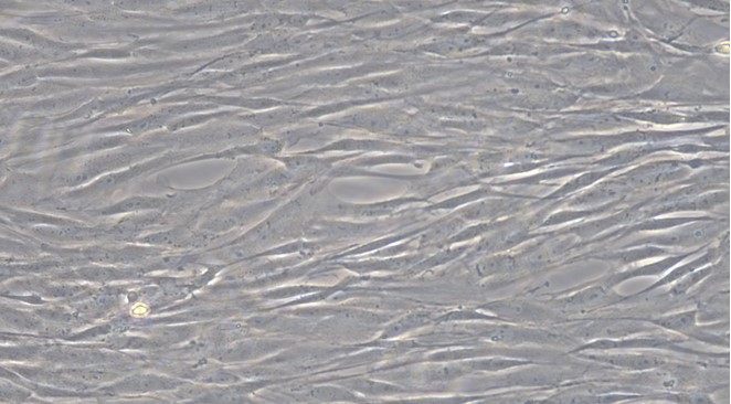 Primary Feline Aortic Smooth Muscle Cells (ASMC)