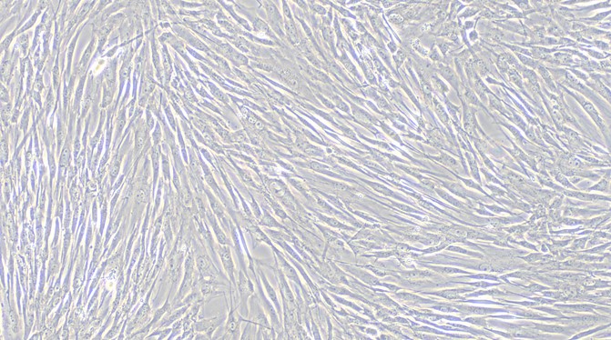 Primary Cavia Aortic Smooth Muscle Cells (ASMC)