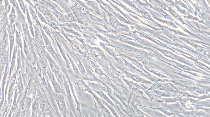 Primary Cavia Aortic Smooth Muscle Cells (ASMC)