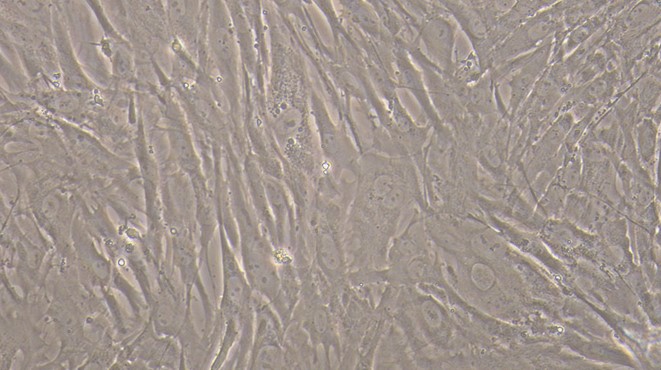 Primary Rabbit Aortic Smooth Muscle Cells (ASMC)