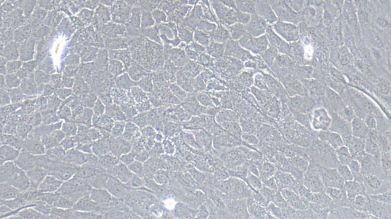 Primary Mouse Seminal Vesicle Epithelial Cells (SVEC)