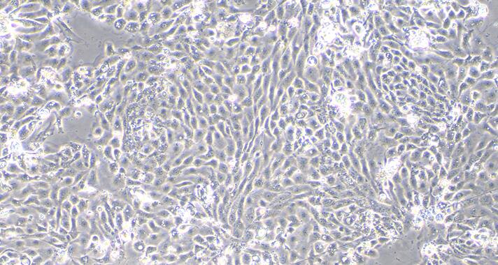 Primary Mouse Seminal Vesicle Epithelial Cells (SVEC)