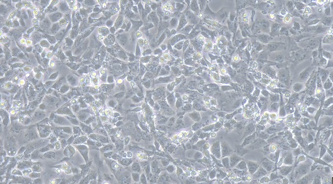 Primary Porcine Prostate Epithelial Cells (PrEC)