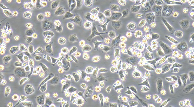 Primary Rabbit Hepatic Macrophages (HM)