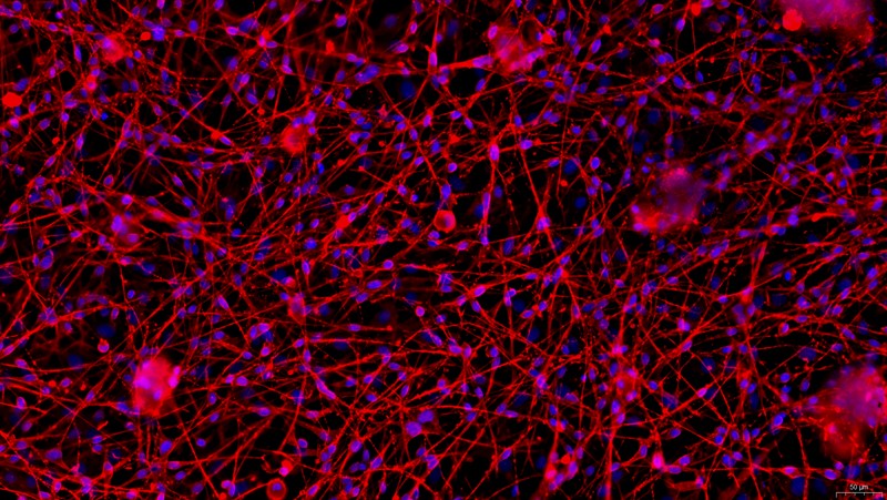 Primary Rat Retinal Ganglion Cells  (RGC)