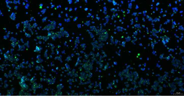 Primary Rabbit Retinal Ganglion Cells  (RGC)