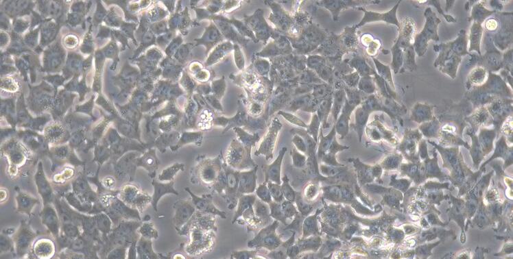 Human Prostate Cancer Cells (PCC)