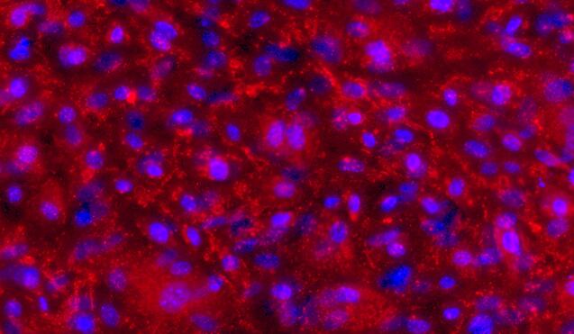 Primary Mouse Peritoneal Mesothelial Cells (PMC)