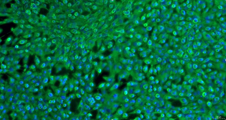 Primary Mouse Peritoneal Mesothelial Cells (PMC)