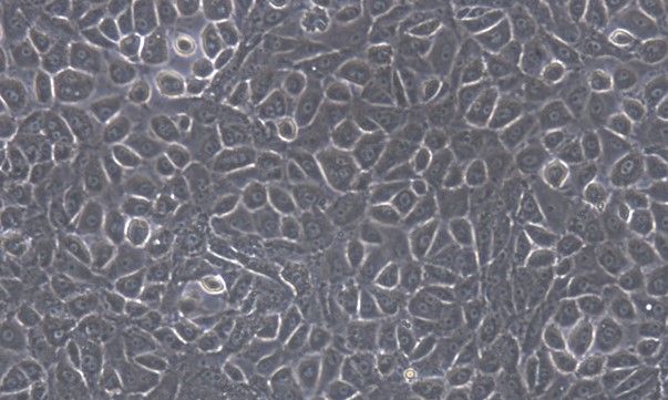 Primary Mouse Peritoneal Mesothelial Cells (PMC)