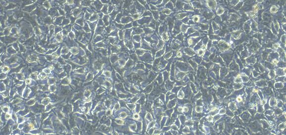 Primary Rabbit Peritoneal Mesothelial Cells (PMC)