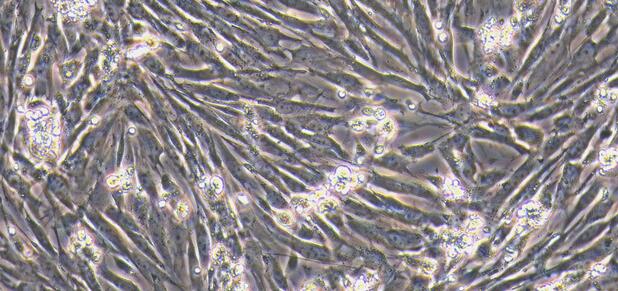 Primary Canine Ureteral Smooth Muscle Cells (USMC)