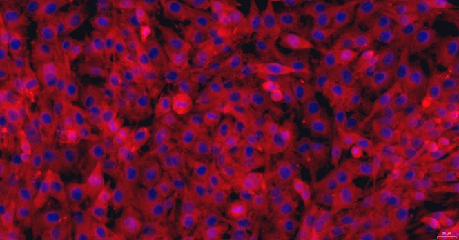 Primary Feline Meniscus Fibrochondrocytes (MFCs)