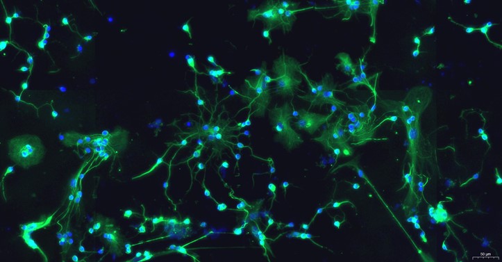 Primary Rat Cerebral Cortex Neuron Cells (CCNC)