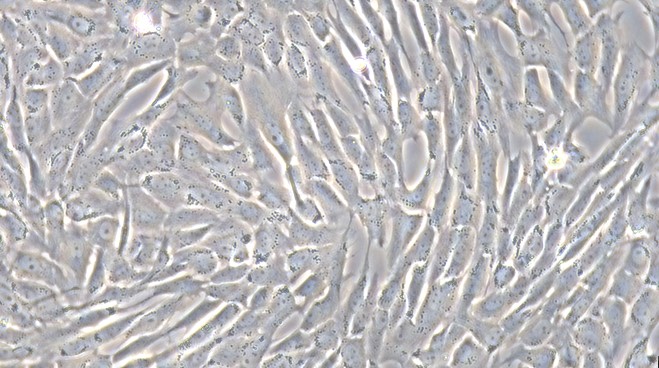 Primary Canine Cardiac Valve Interstitial Cells (CVIC)