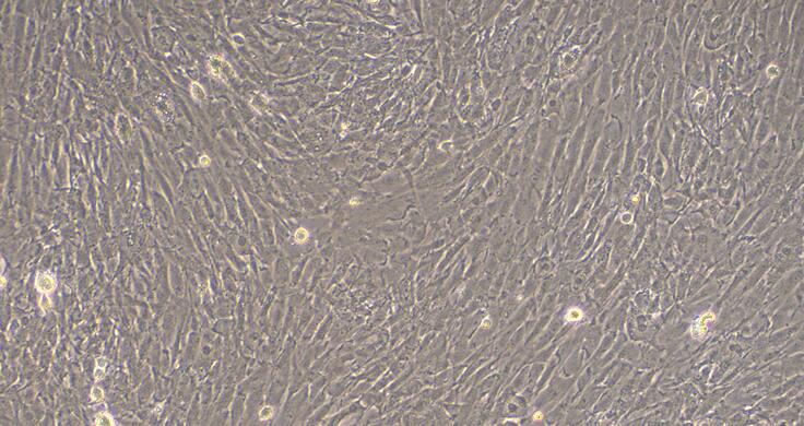 Primary Caprine Cardiac Valve Interstitial Cells (CVIC)