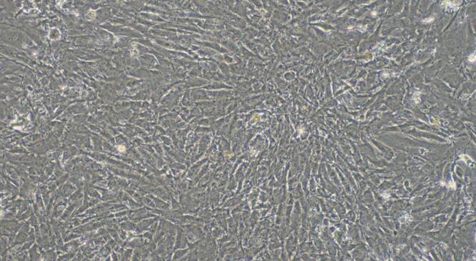 Primary Rabbit Cardiac Valve Interstitial Cells (CVIC)