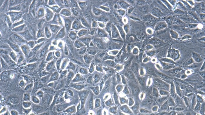 Primary Feline Pericardial Mesothelial Cells (PeMC)