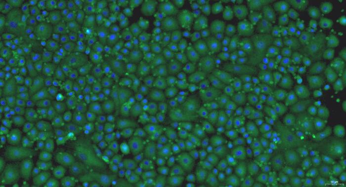 Primary Rat Pericardial Mesothelial Cells (PeMC)