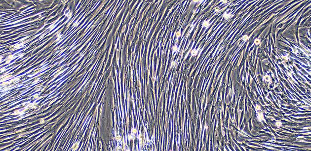 Primary Canine Vaginal Smooth Muscle Cells (VSMC)